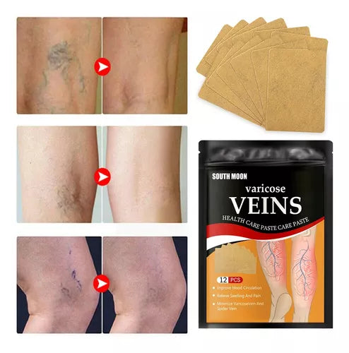 PARCHES PARA VARICES 🩹🌟 PIERNAS SIN DOLOR Y RENOVADAS 🌟 (2x1)